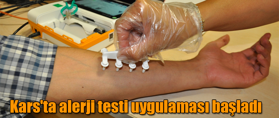 Kars'ta alerji testi uygulaması başladı